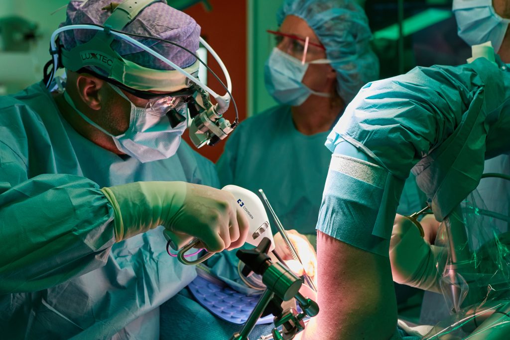 Chirurgen in operatiekleding voeren een thoracic outlet decompressie uit aan het been van een patiënt op de operatiekamer.