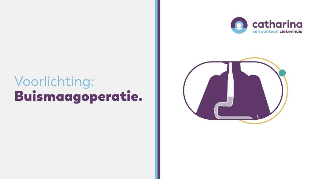 Dia met links de tekst 'Voorlichting: buismaagoperatie', rechts een diagram van maagchirurgie, Catharina-logo rechtsboven.
