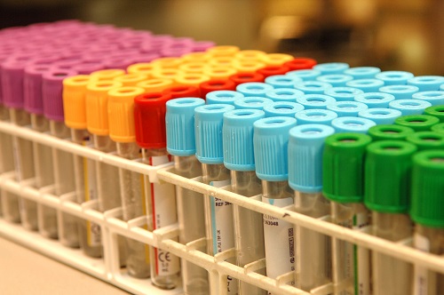 Close-up van lege buisbloedafnametubes met gekleurde doppen in wit rek voor huisartsenlaboratorium, op vage achtergrond.