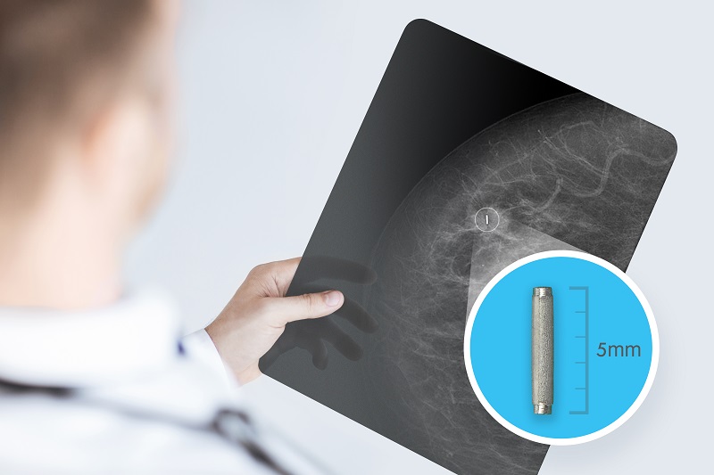 Een arts toont een mammografie met markering van een jodiumzaadje (5mm), veelgebruikt bij borstkankeroperaties.