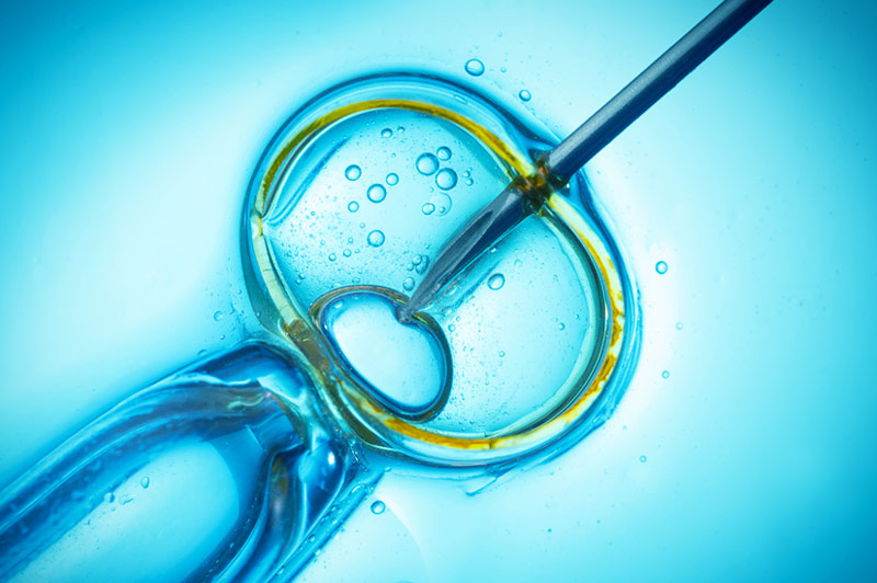 Close-up van een naald die genetisch materiaal in een eicel onder de microscoop brengt, bij IVF of genetische manipulatie.