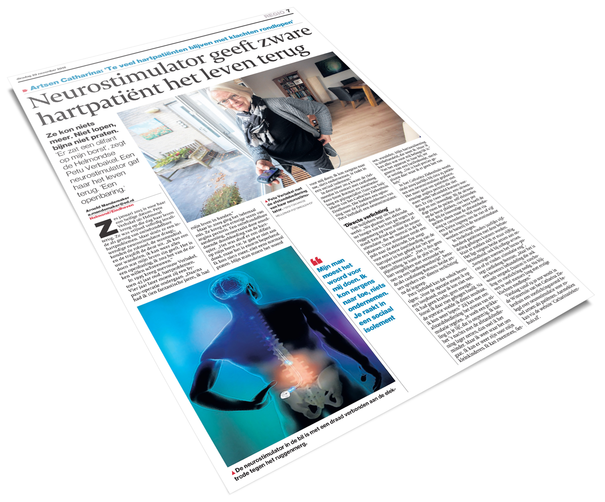 Krantenartikel met bovenin een vrouw en kind in woonkamer, onderin illustratie van torso met zenuwen en neurostimulator.