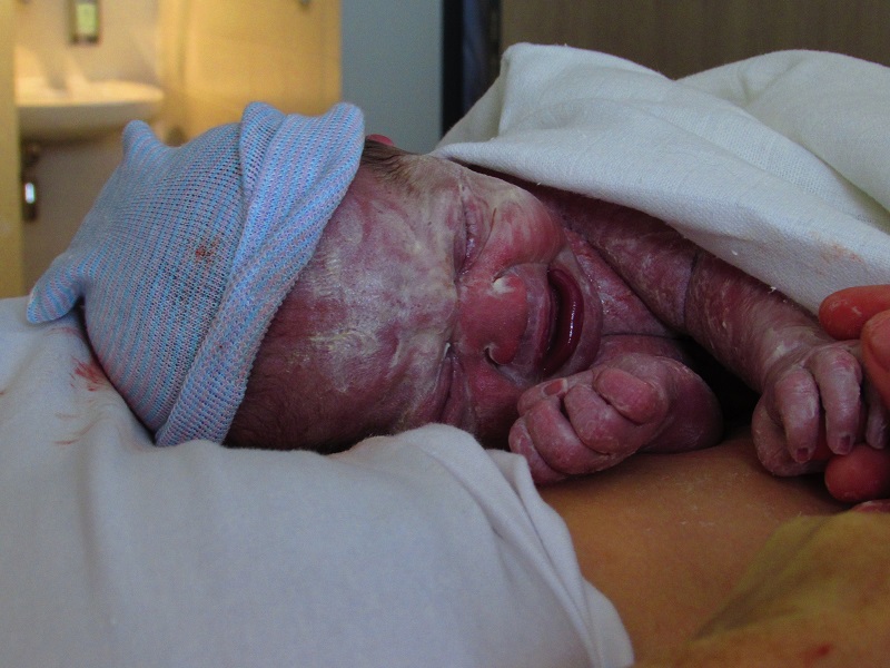 Pasgeboren baby met vernix en blauw mutsje huilt op witte doek, in klinische omgeving, met volwassen hand ernaast.