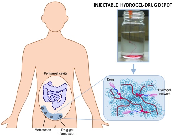 Schema van een romp met gemarkeerde buikholte; chemo-gel wordt geïnjecteerd bij kanker. Inzet: hydrogel-ampul, schema gel.
