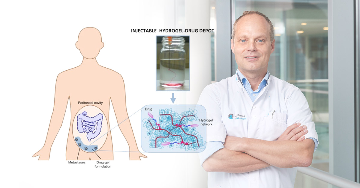 Arts in witte jas naast diagrammen van hydrogel-drugdepot bij medicijnafgifte; close-up van medicijn in hydrogelnetwerk.
