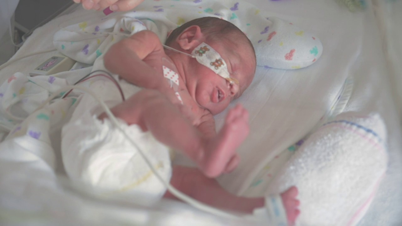 Een pasgeboren baby in een couveuse met luier, medische slangetjes en neusbril ligt op een dekentje in het ziekenhuis.