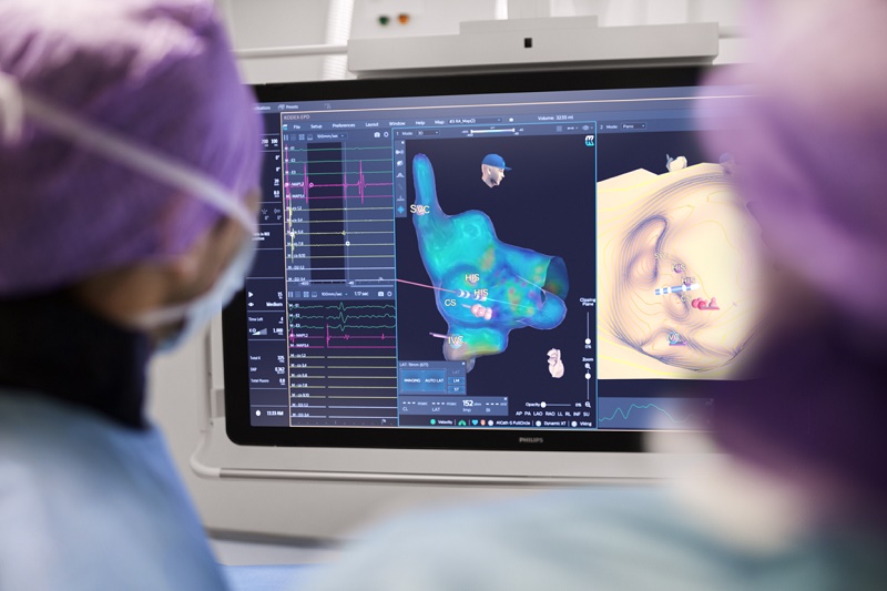 Twee artsen in operatiekleding bekijken een monitor met 3D-anatomiemodel, hittekaart en grafieken bij een behandeling van boezemfibrilleren.