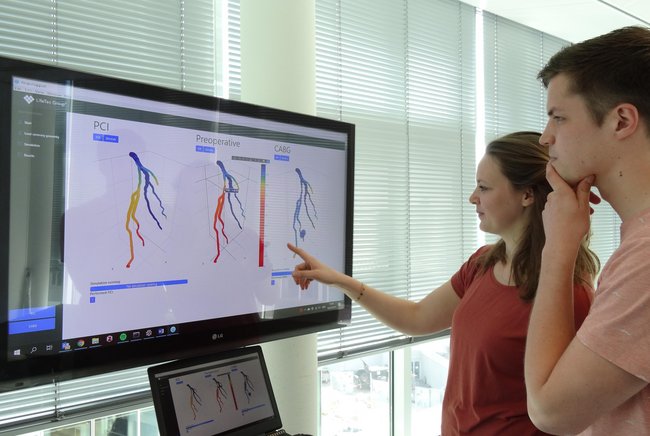 Twee mensen bij groot scherm met vasculaire diagrammen (PCI, Preoperatief, CABG); één wijst op kransslagadervernauwing.