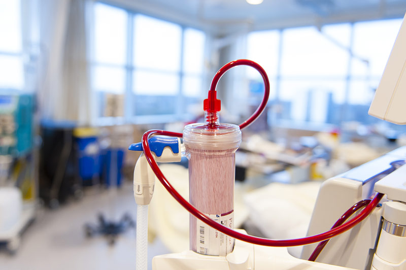 Hemodialyseapparaat met bloedgevulde filter en rode slangen bij nierfalen, in een kliniek. Op de achtergrond een vage ziekenhuisruimte.