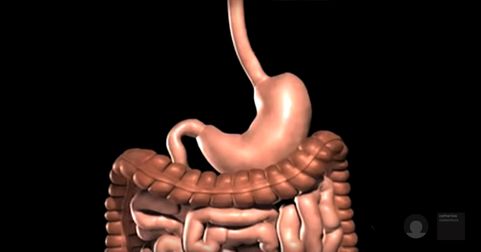 Digitale illustratie van het spijsverteringsstelsel met focus op delen betrokken bij een gastric bypass, op zwarte achtergrond.