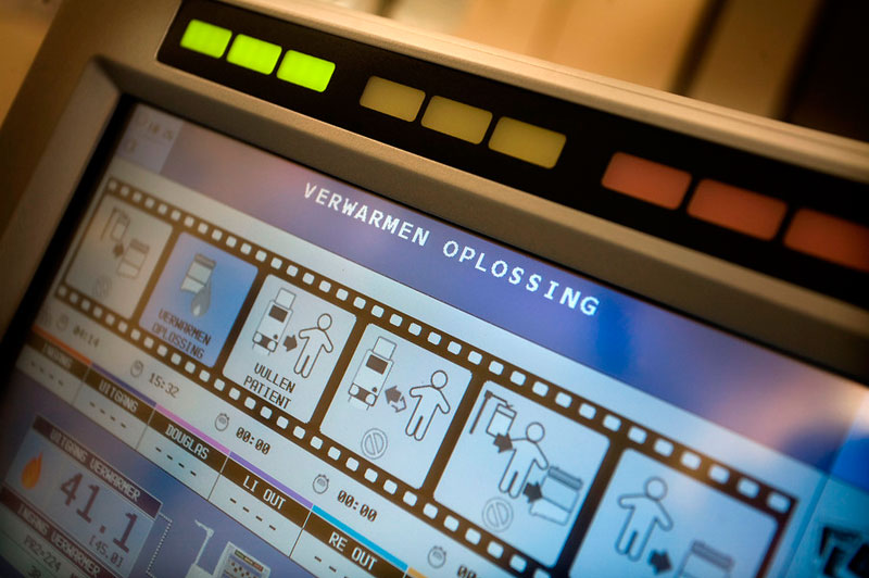Close-up van een medisch apparaatscherm met Nederlandstalige instructies en status over buikspoeling bij eierstokkanker.