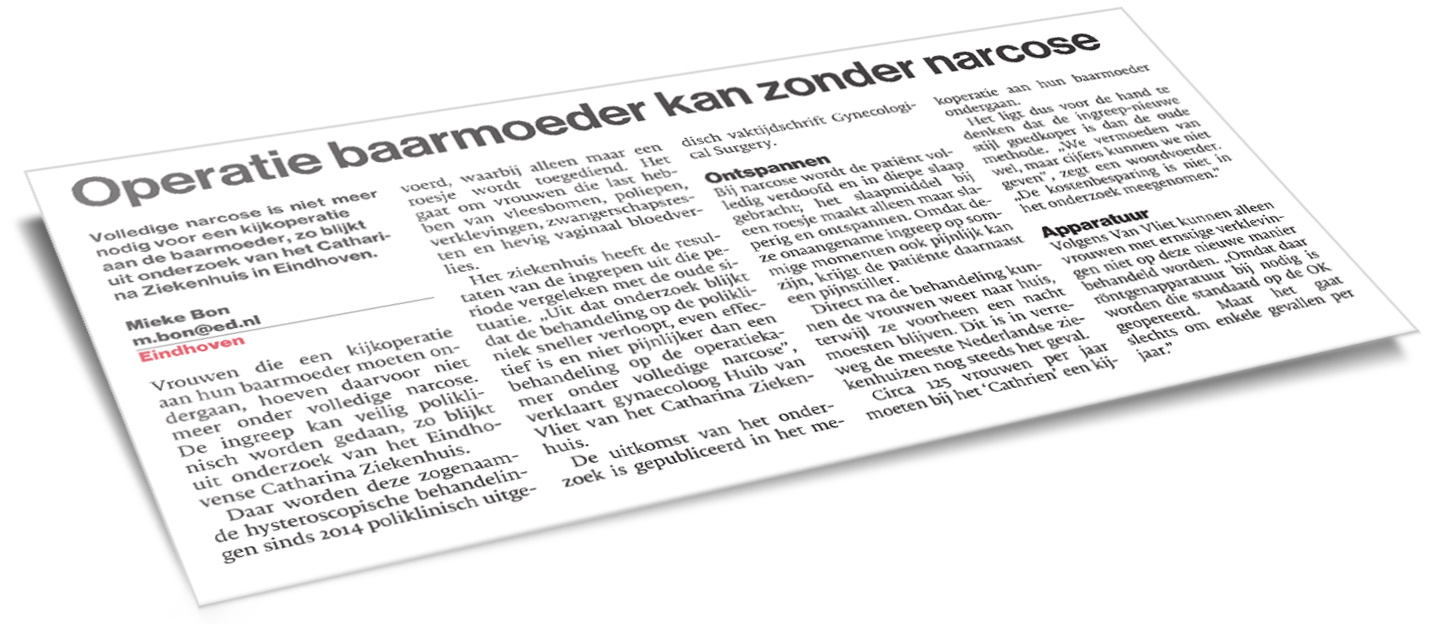 Nederlandstalig krantenartikel 'Operatie baarmoeder kan zonder narcose' over ingreep zonder narcose in Catharina Ziekenhuis.