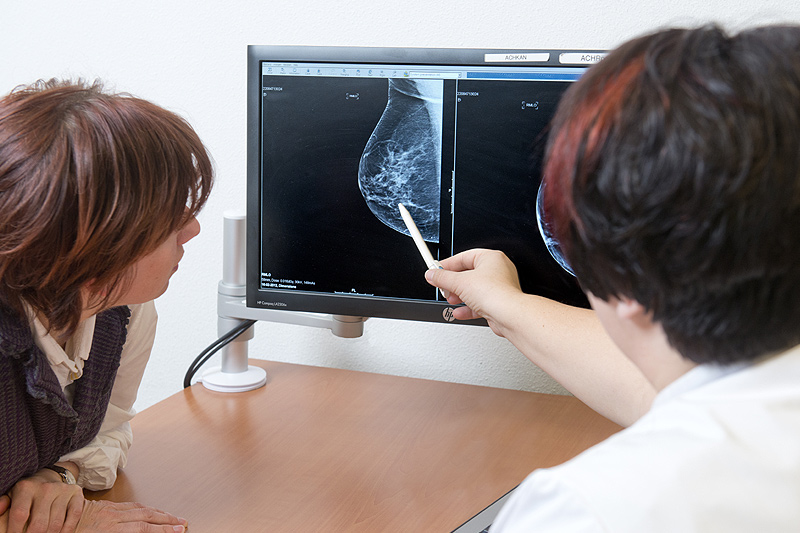 Een zorgverlener bespreekt een mammografie op een computerscherm met een patiënt tijdens een borstkankerscreening.