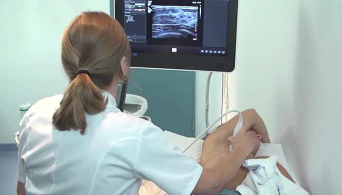 Een arts in Nederland voert een echografie uit bij een patiënt die op een onderzoekstafel ligt met één arm boven het hoofd.