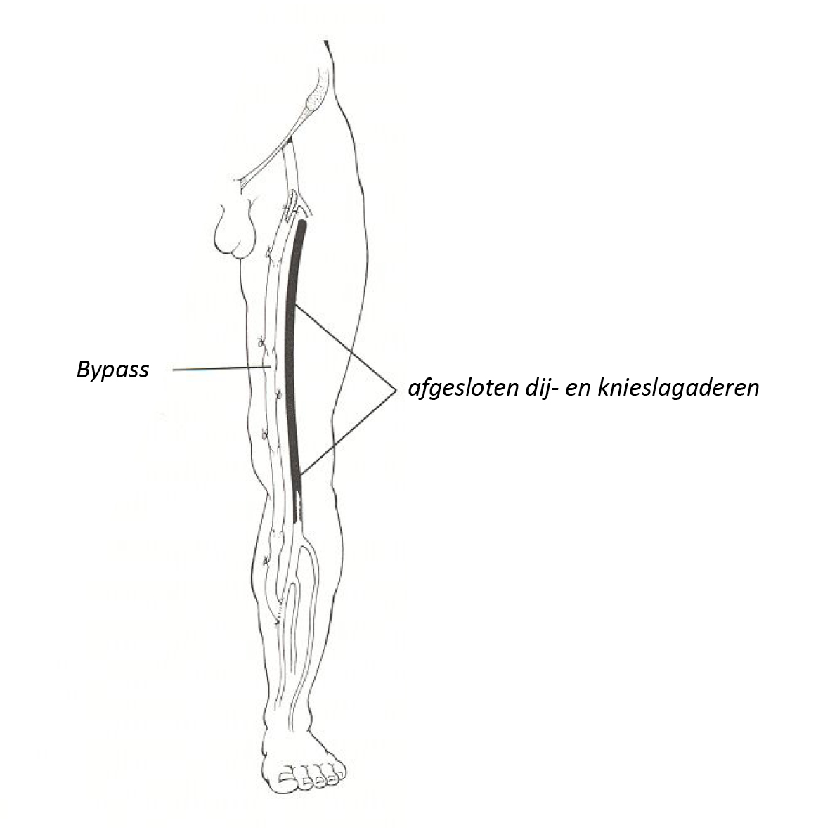 CHI033 CC.jpg