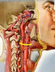 Anatomische illustratie van de zijkant van het hoofd en de hals, met halsslagader, labels en zichtbare kaak en wervels.