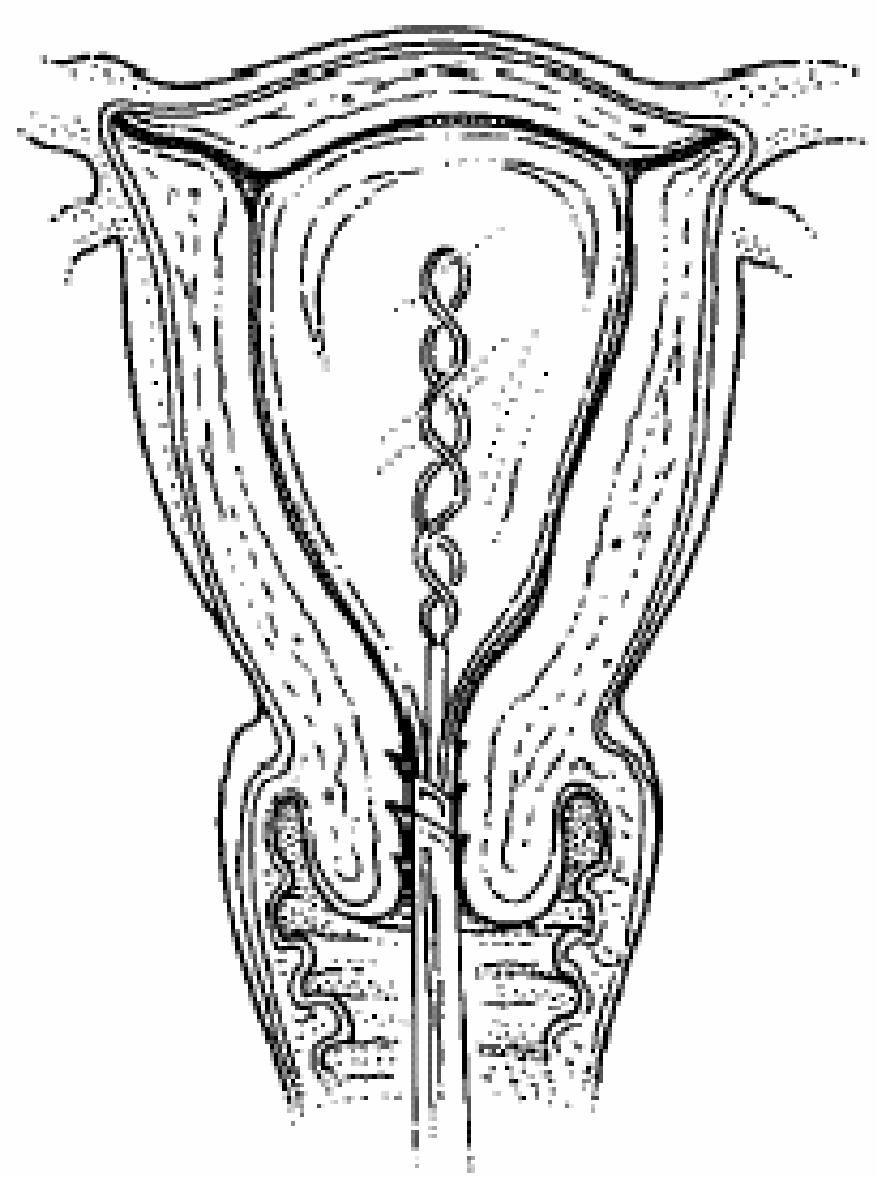 GYN088 B.png