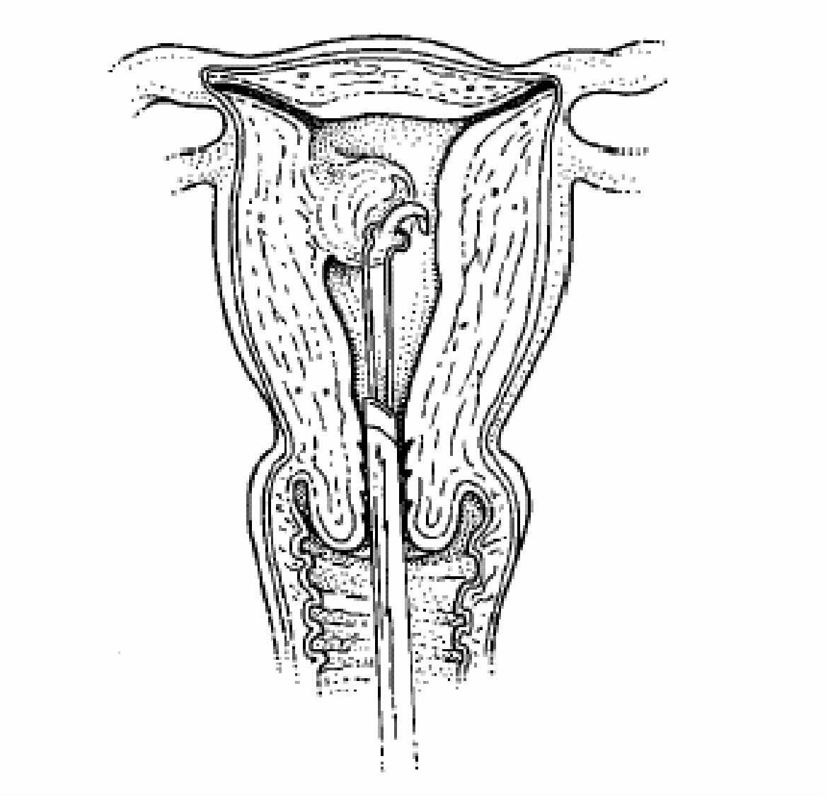 GYN088 D.png