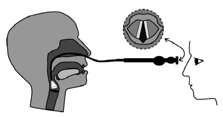 KNO033 A.png