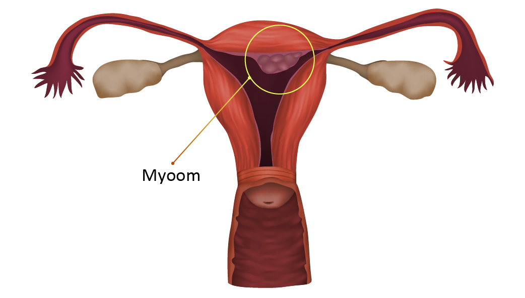 Myoom01.jpg
