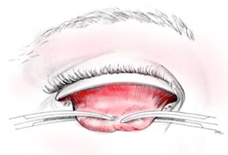 OOG001 G.png