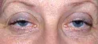 OOG001 i.png