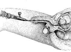 URO010 A.png