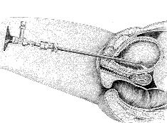 URO010 B.png