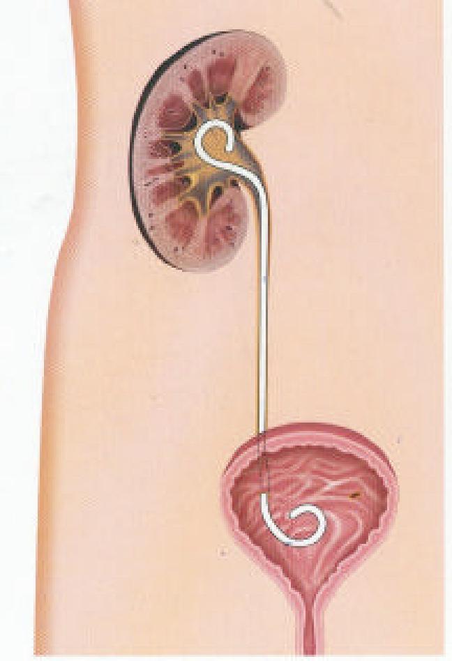 URO012 A.png