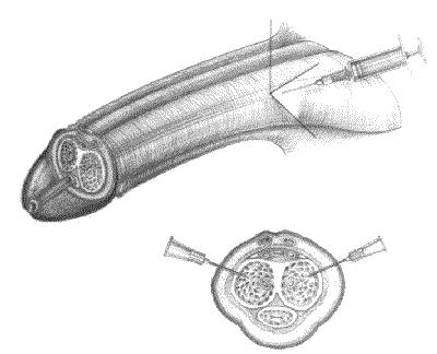 URO043 A.png
