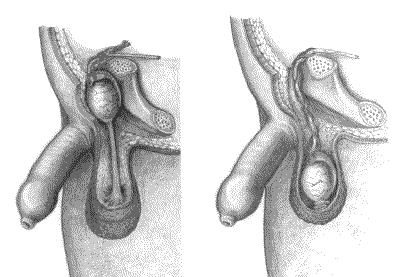 URO049 A.png