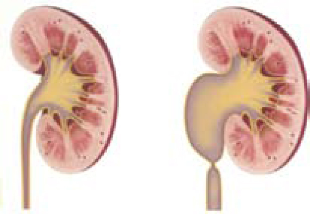 URO064 A.jpg