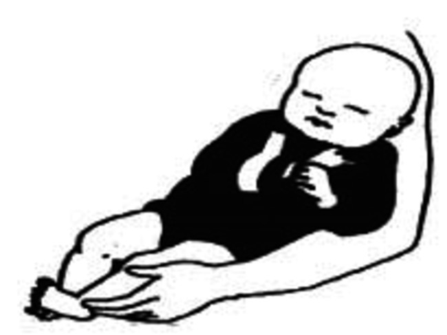 Gebrokensleutelbeen_baby_afb1.jpg