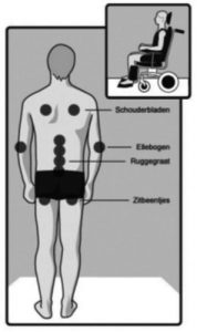 Diagram van rugzijde menselijk lichaam met drukpunten voor decubitus bij schouders, ellebogen, wervelkolom en zitbeenderen; inzet: rolstoelgebruiker.