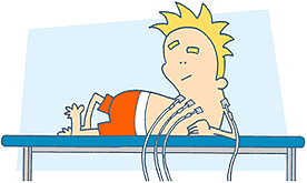 ECG