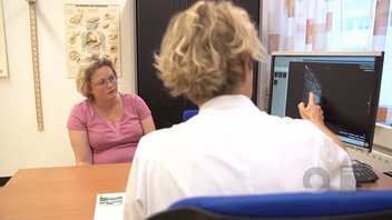 Een arts toont een medische afbeelding op een computerscherm aan een patiënt in roze, en legt borstkanker uit op kantoor.