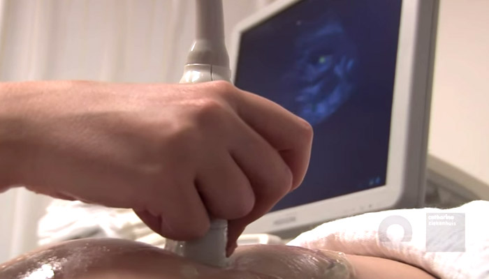 Close-up van een hand met een echokop op een buik, ultrasoon beeld op monitor; gebruikt in voorlichting over verloskunde.