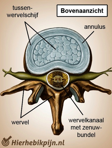 wervelkolom-wervel-bovenaanzicht-tussenwervelschijf-zenuwen.jpg