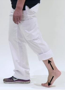 Persoon met witte broek en zwart shirt zet stap vooruit, rechtervoet met blessure raakt met tenen de grond. Zwarte pijlen wijzen van hiel naar tenen.