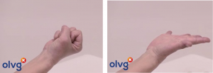 Twee afbeeldingen tonen een linkerhand: eerst in vuist, dan open, beide met handpalm omhoog. Illustratie van middenhandsbeentje fractuur met olvg logo.