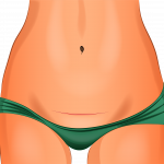 Illustratie van het onderlichaam van een vrouw met een horizontaal litteken boven de schaamstreek en groene slip.