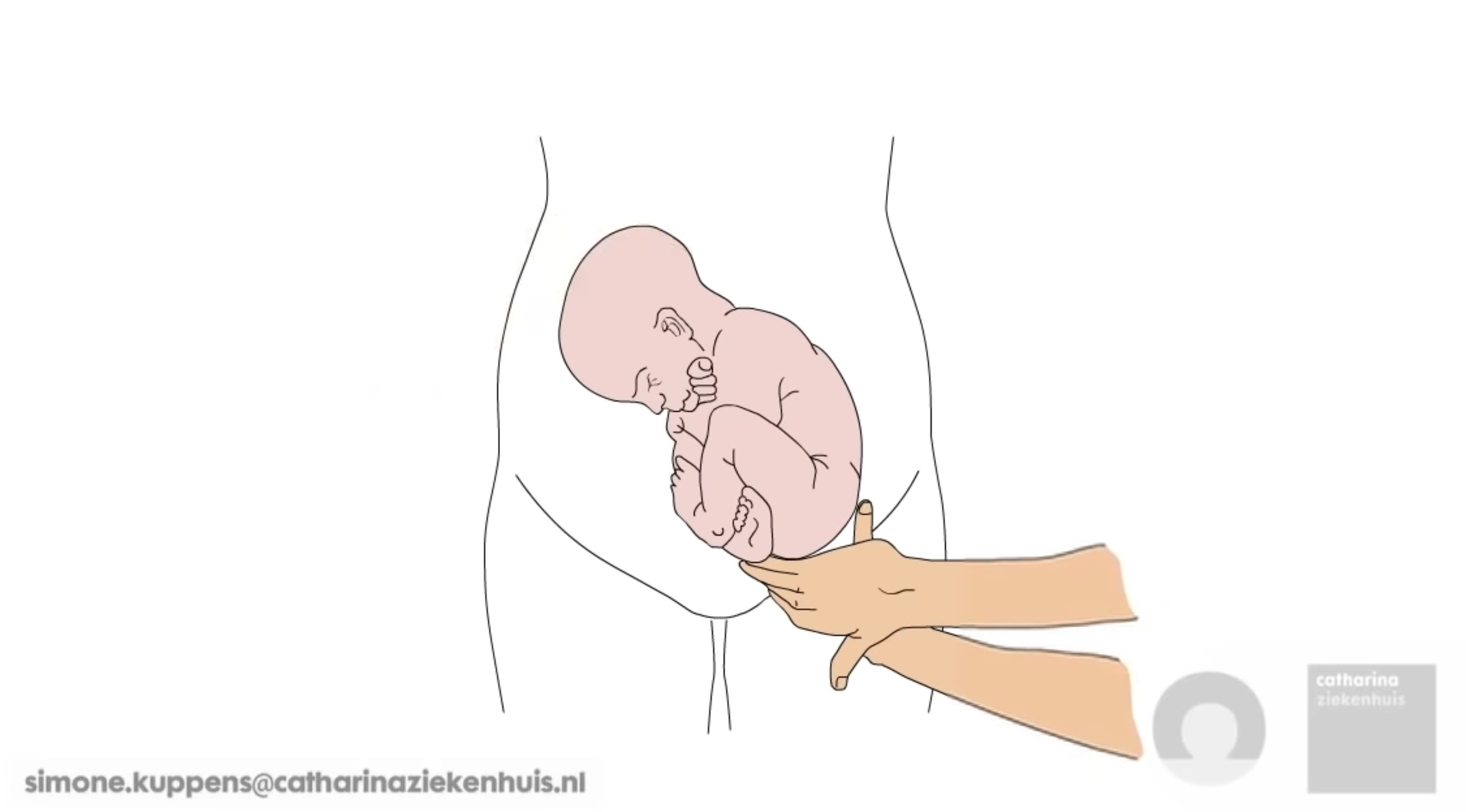 Illustratie van een baby in foetushouding, hoofd ondersteund door handen, voor simplistische torso en bekken.