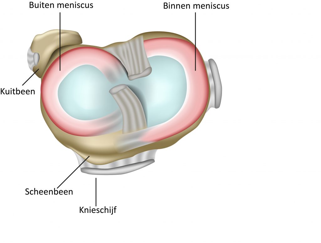 Doorsnede van het kniegewricht met Nederlandse labels: buitenmeniscus, kuitbeen, scheenbeen en knieschijf.