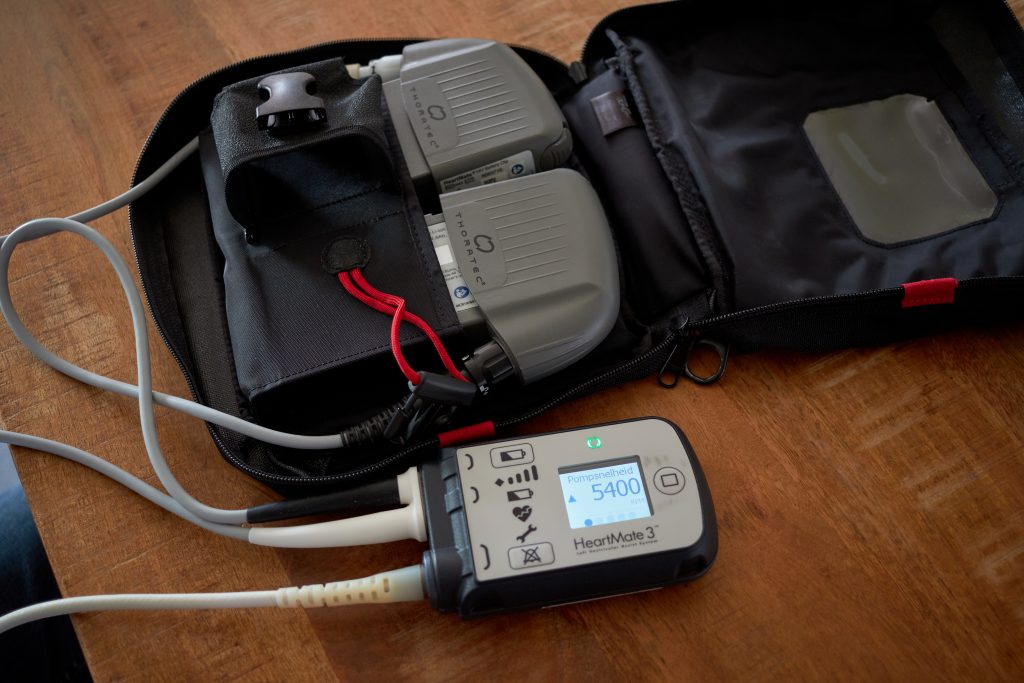 Een HeartMate 3 LVAD-controller met twee batterijen deels in een zwarte tas op houten ondergrond. Display toont 5400 RPM.