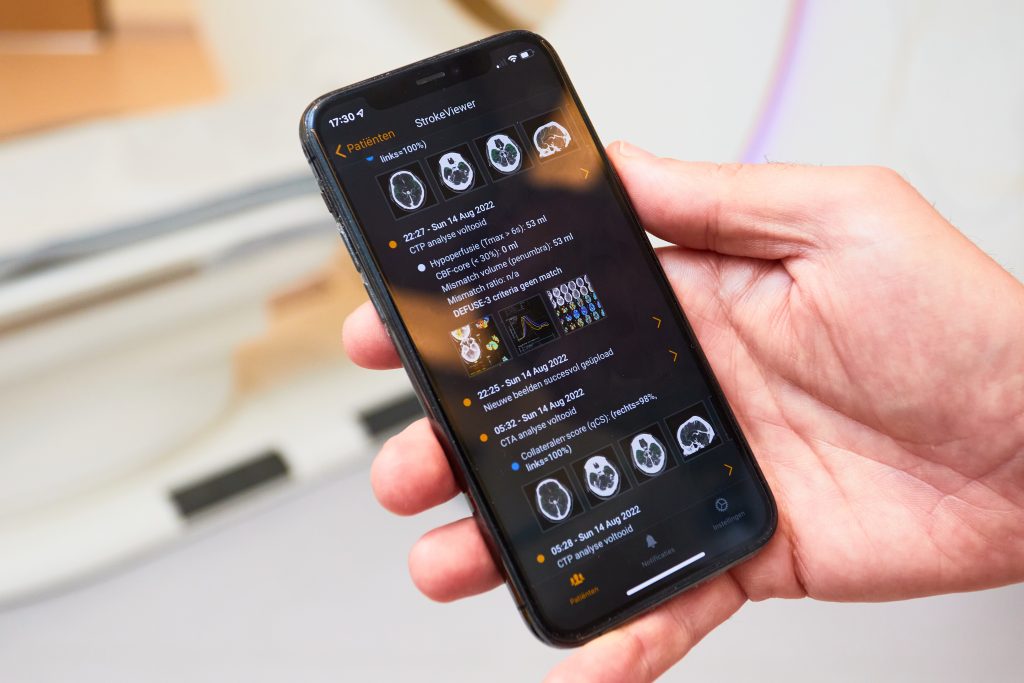 Hand met smartphone met medische app toont hersenscan en patiëntinfo, focus op tijdwinst bij beroerte, onscherpe achtergrond.