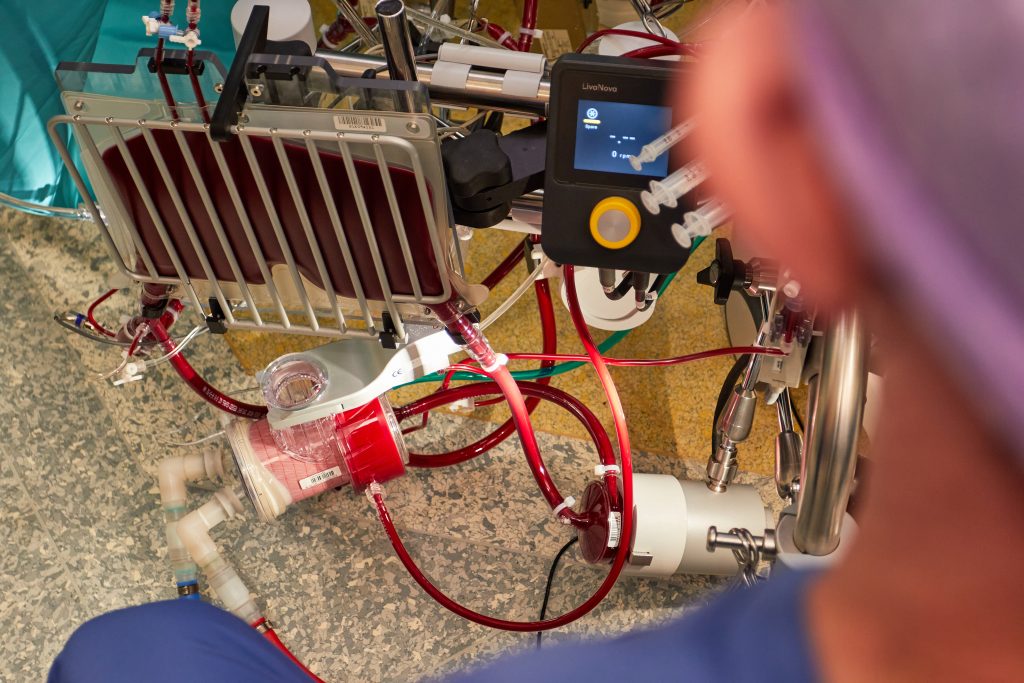 Een arts bekijkt een hart-longmachine met buizen, bedieningspanelen en schermen in het Catharina Hart- en Vaatcentrum.
