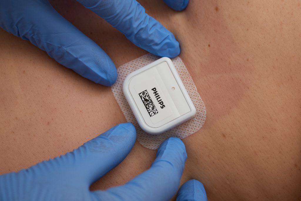 Een persoon met blauwe handschoenen plaatst een witte Philips sensor met QR-code op iemands huid voor monitoring.