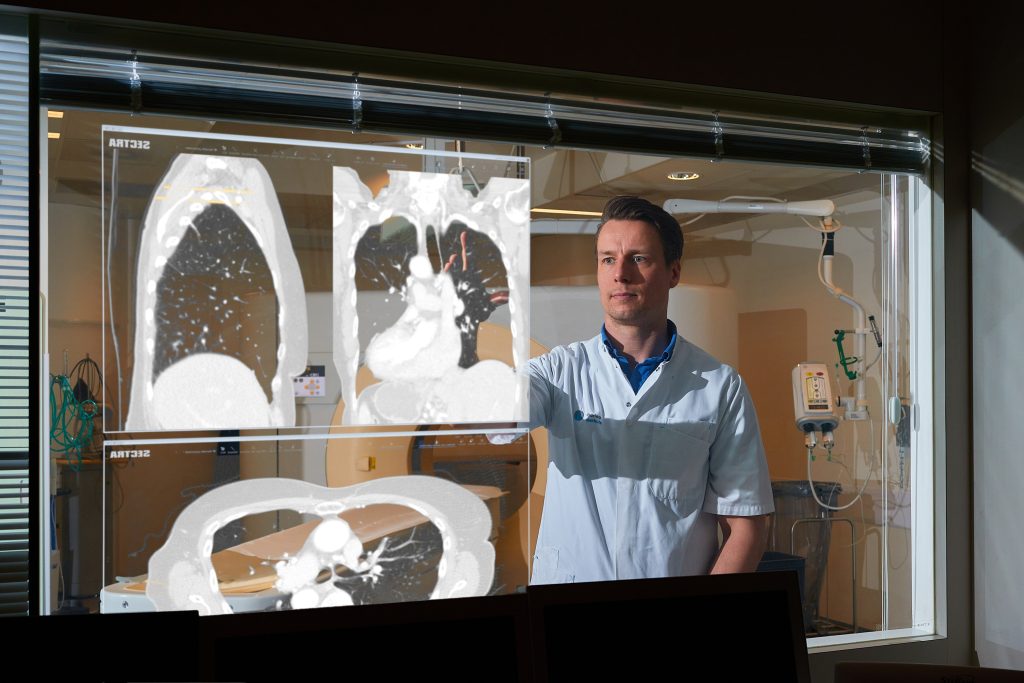 Een man in een labjas staat achter een glasplaat met CT-beelden van een borst. Medische apparatuur op de achtergrond.