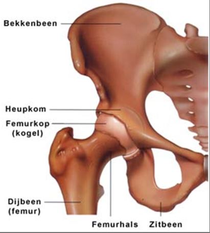 Diagram van het heupgewricht met Nederlandse labels: bekkenbeen, heupkom, femurkop, dijbeen, femurhals en zitbeen.
