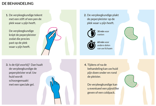 Illustratie met 4 stappen: schouder aftekenen, Qutenza-pleister plakken, verwijderen en huid inspecteren.